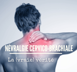 nevralgie cervico brachiale que faire