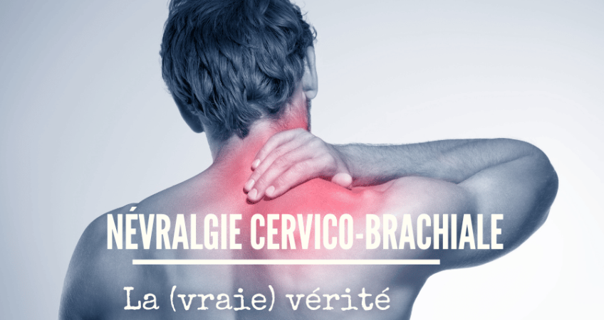 nevralgie cervico brachiale que faire